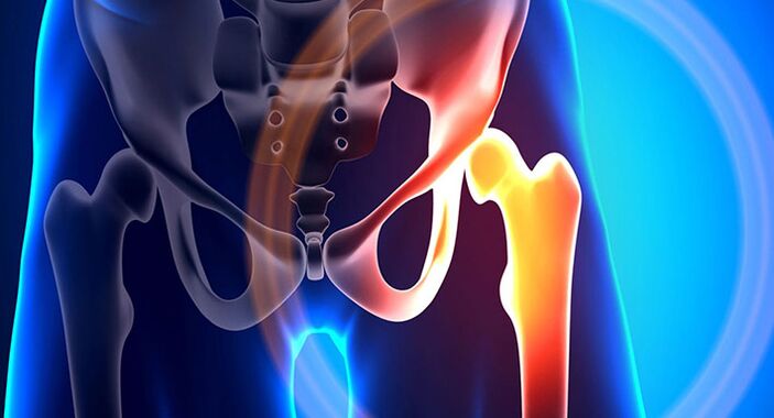 Pain in the hip joint is a symptom of many different pathologies